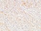 MIB1 Polyclonal Antibody